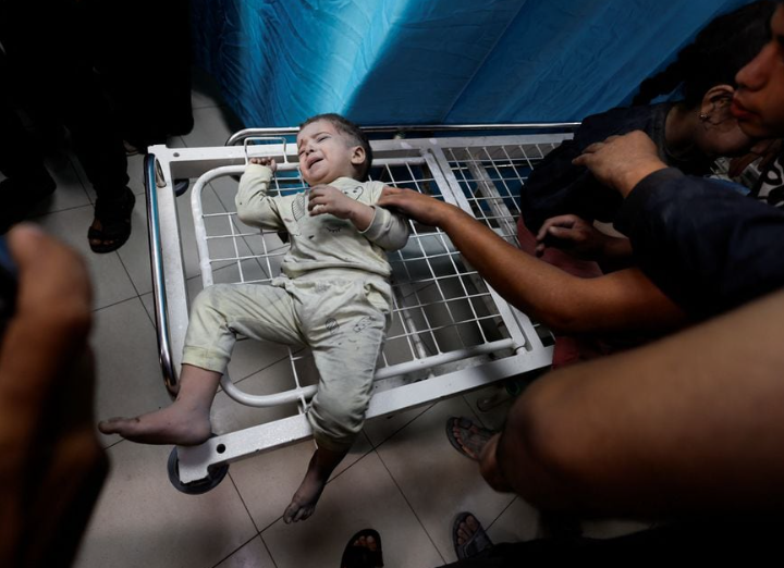 Seorang anak Palestina yang terluka dalam serangan Israel menunggu untuk menerima perawatan di rumah sakit Nasser di Khan Younis di selatan Jalur Gaza 12 November 2023. REUTERS/Mohammed Salem Memperoleh Hak Lisensi